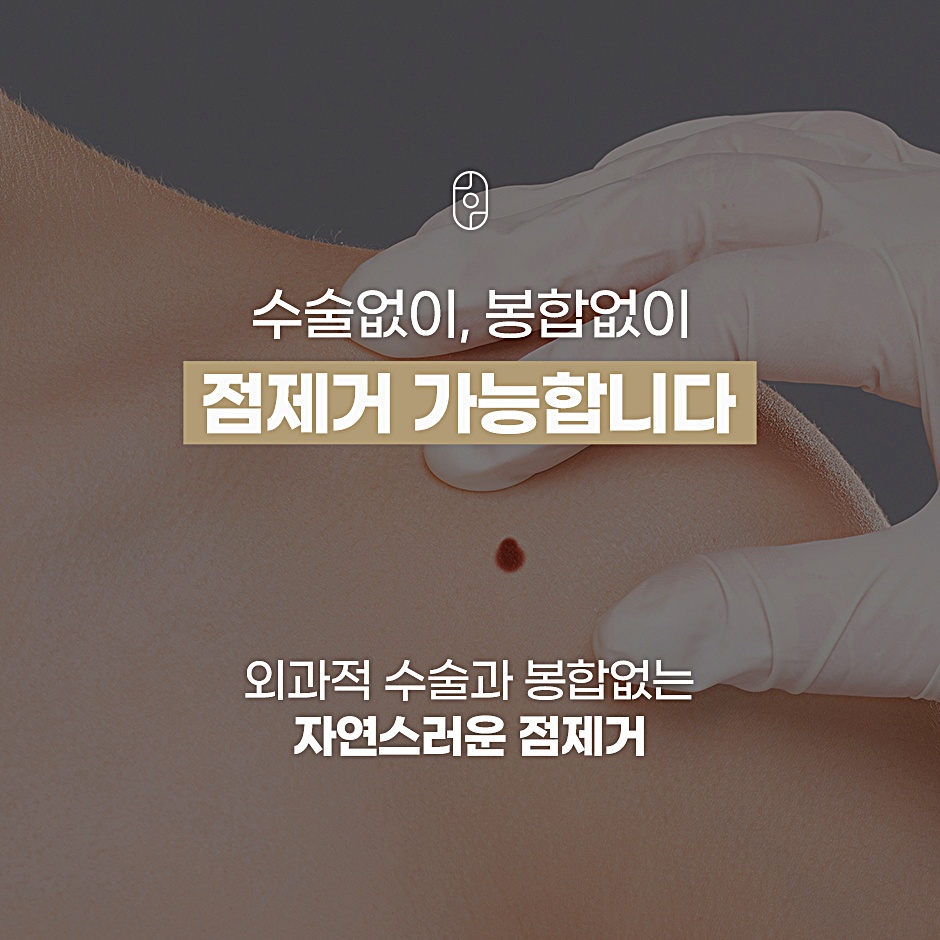 수술 없이 봉합 없이 가능한 점제거, 외과적 수술과 봉합 없는 자연스러운 점제거