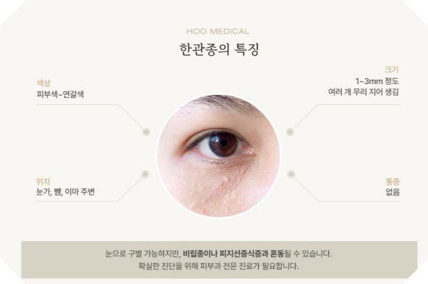 전주 한관종 특징 설명 