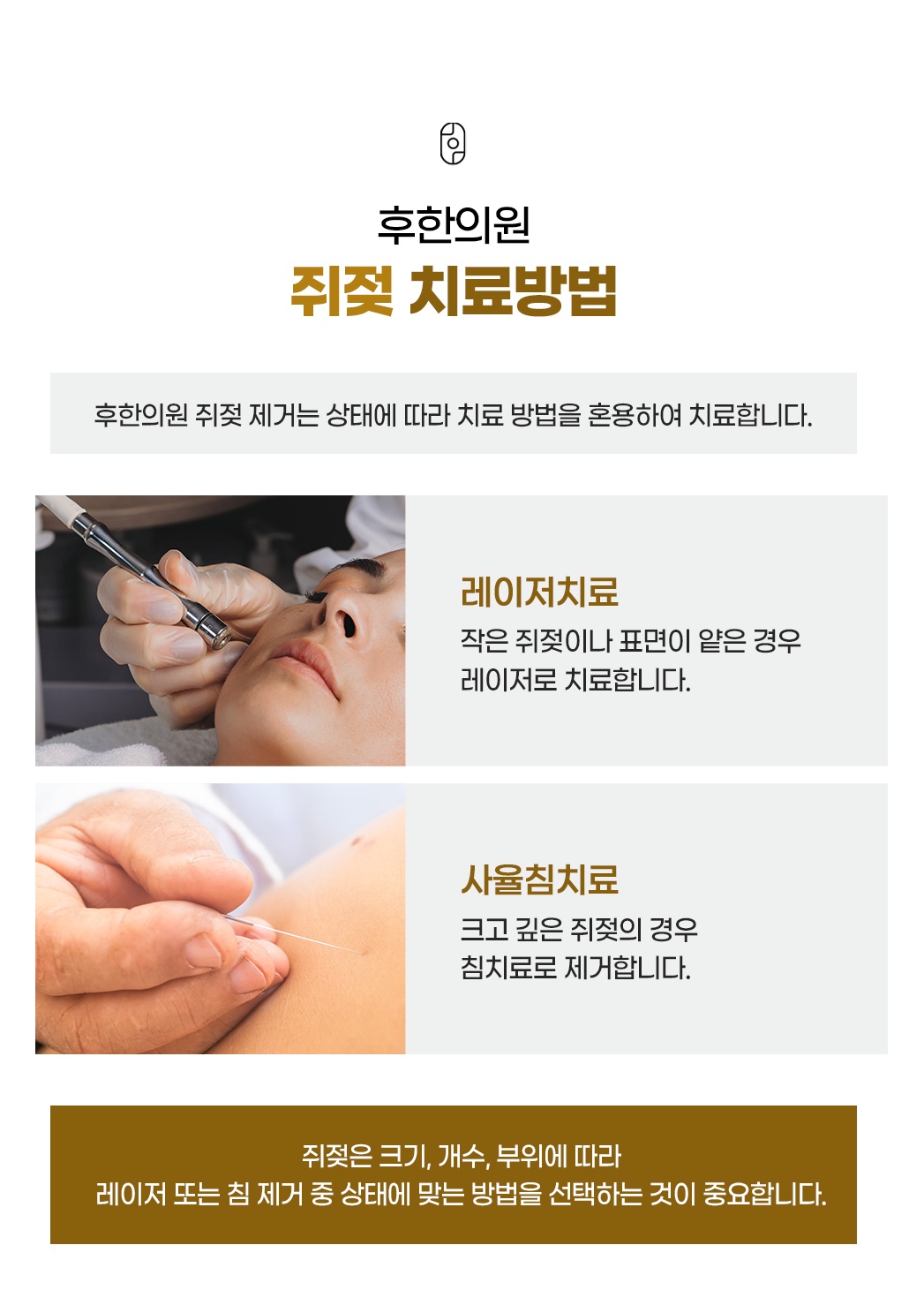 후한의원 쥐젖 레이저치료 사율침치료 방법 비교