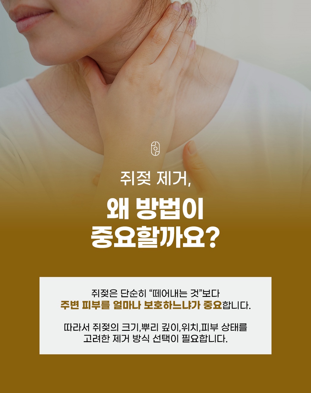 쥐젖 제거 시 주변 피부 보호 중요성 설명