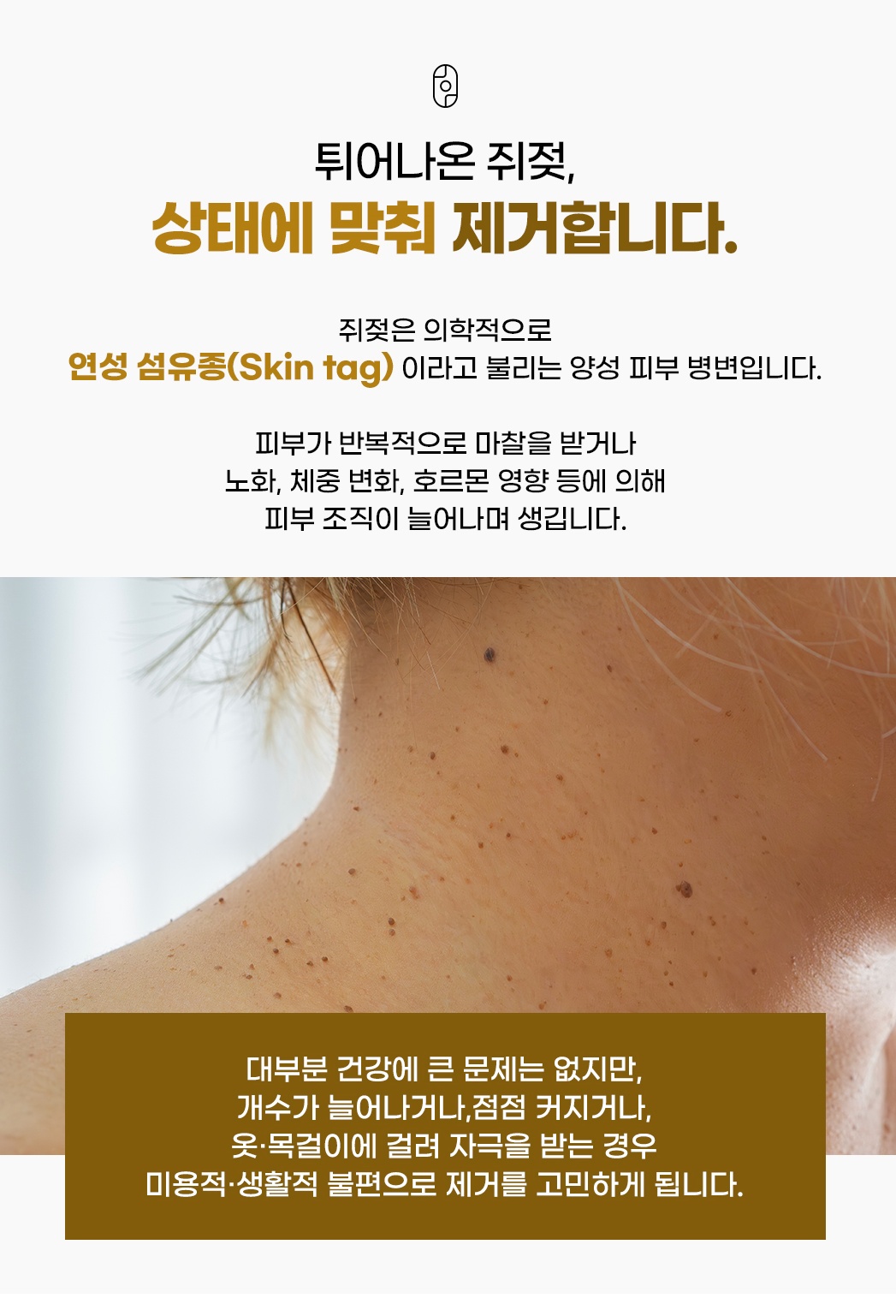 	쥐젖 연성섬유종 목 부위 병변 사진과 생기는 원인 설명