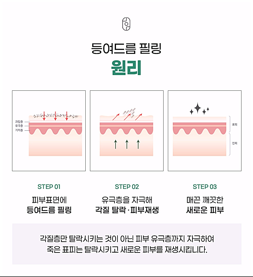 전주 등드름 필링 원리, 피부표면에 필링 도포 후 유극층 자극으로 각질 탈락 및 재생