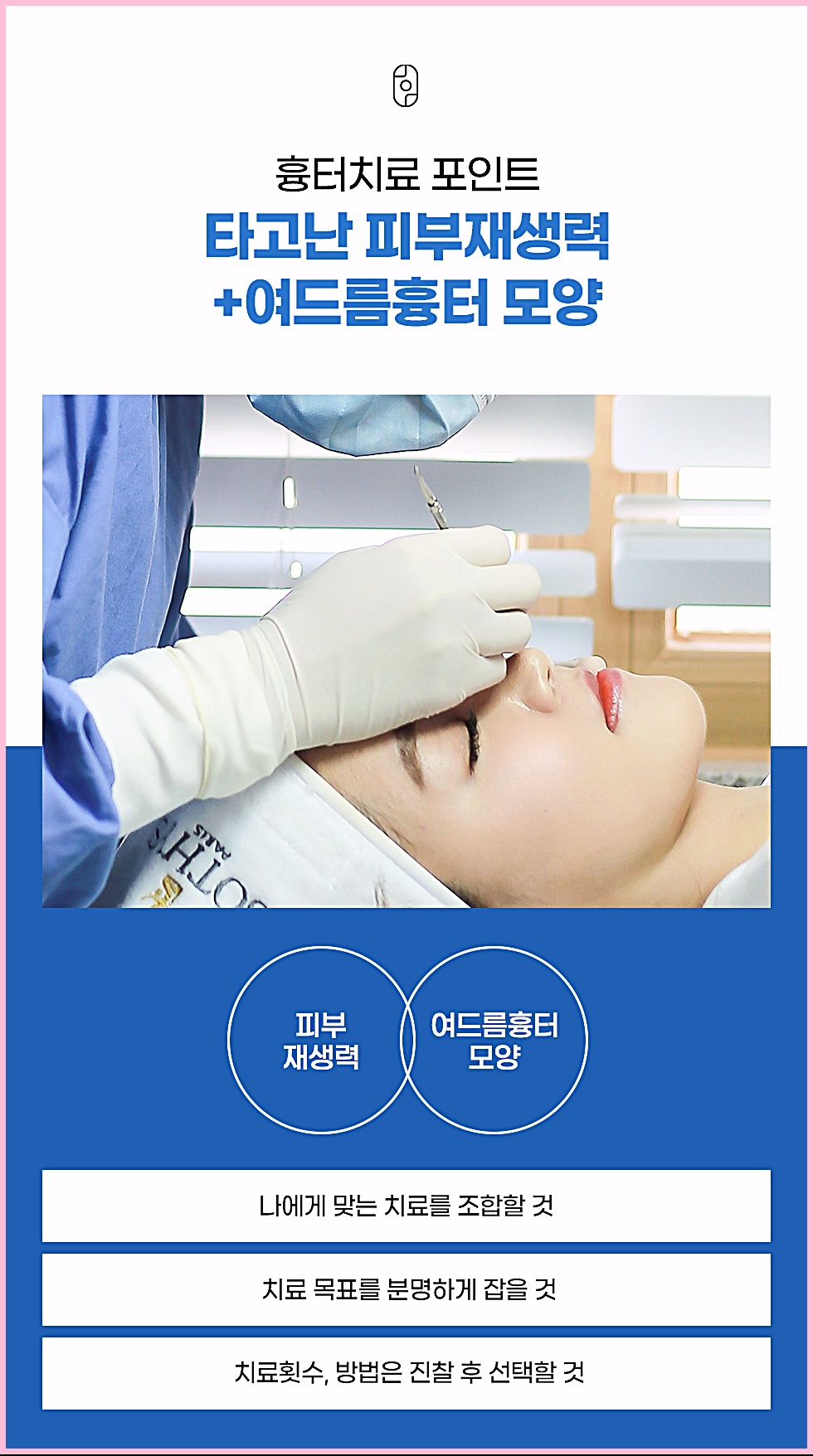 전주여드름흉터 치료 포인트 - 피부재생력과 흉터 모양을 고려한 트랜스테라피 시술