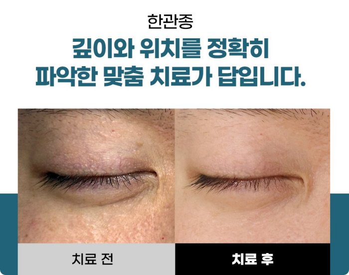 전주아그네스 한관종 전후사진 