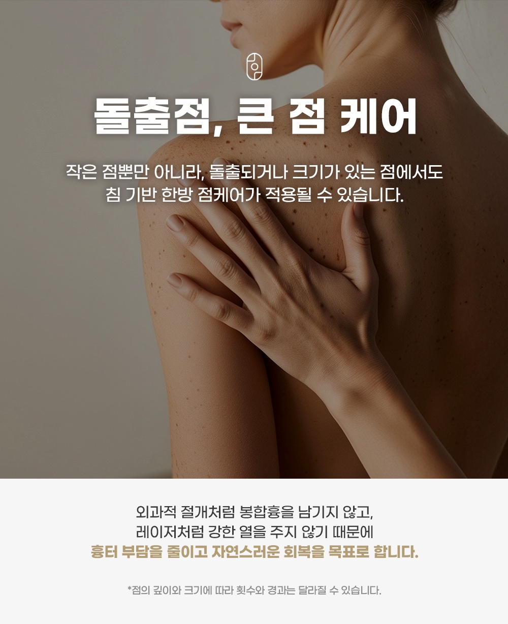 어깨와 등에 점이 퍼진 피부로 보는 돌출점·큰 점 침 기반 한방 케어