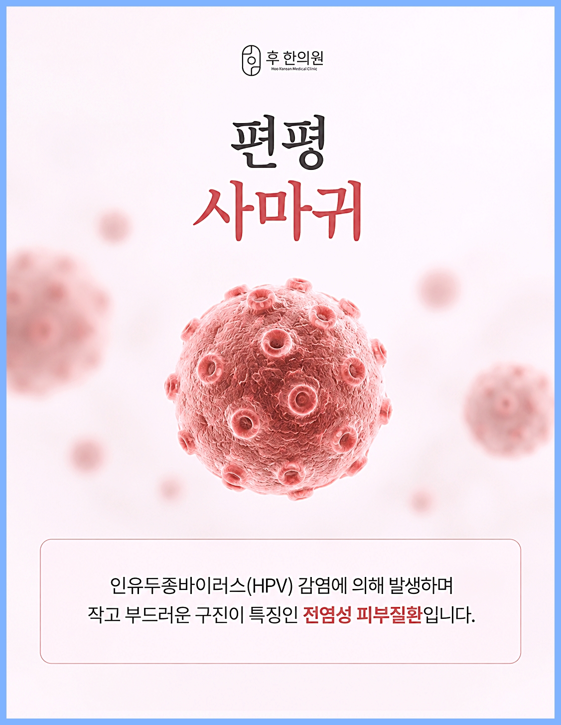 후한의원 전주점 편평사마귀 인유두종바이러스 감염 안내