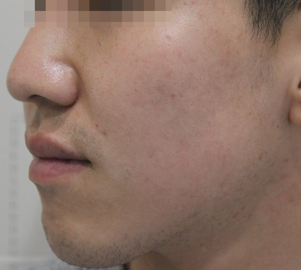 After