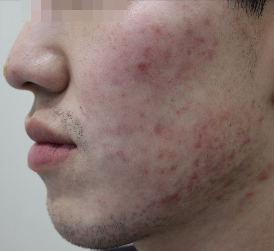 Before