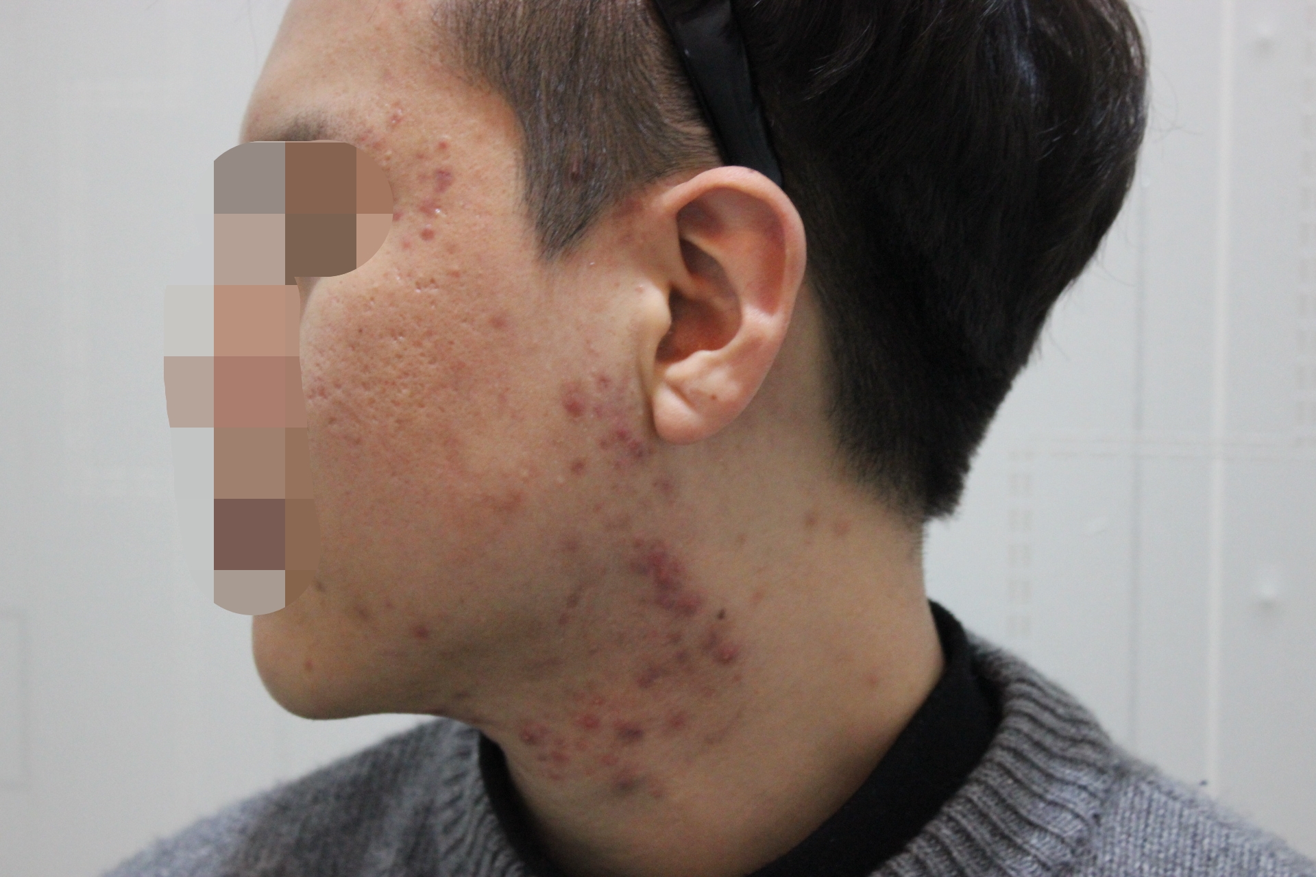 Before