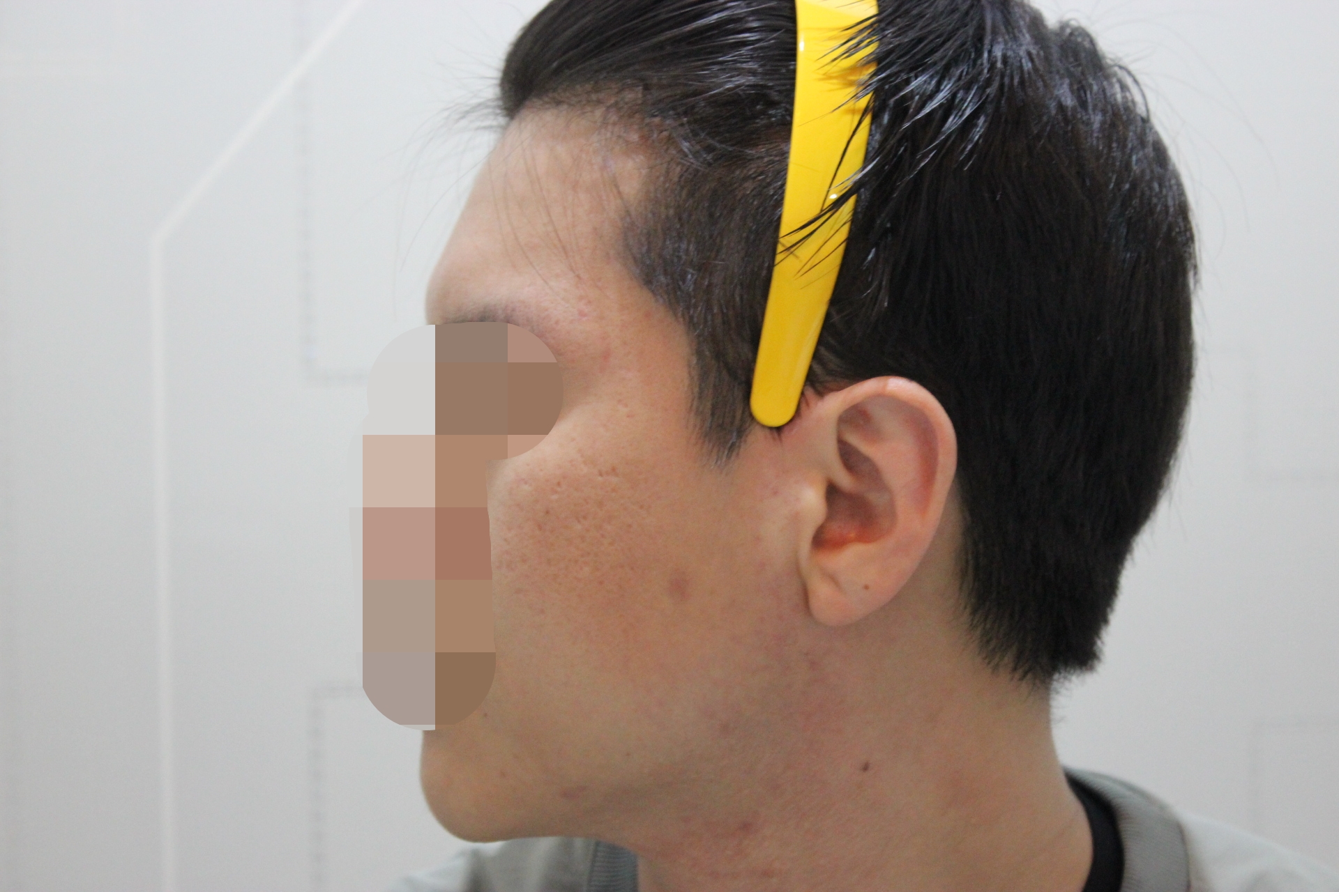 After