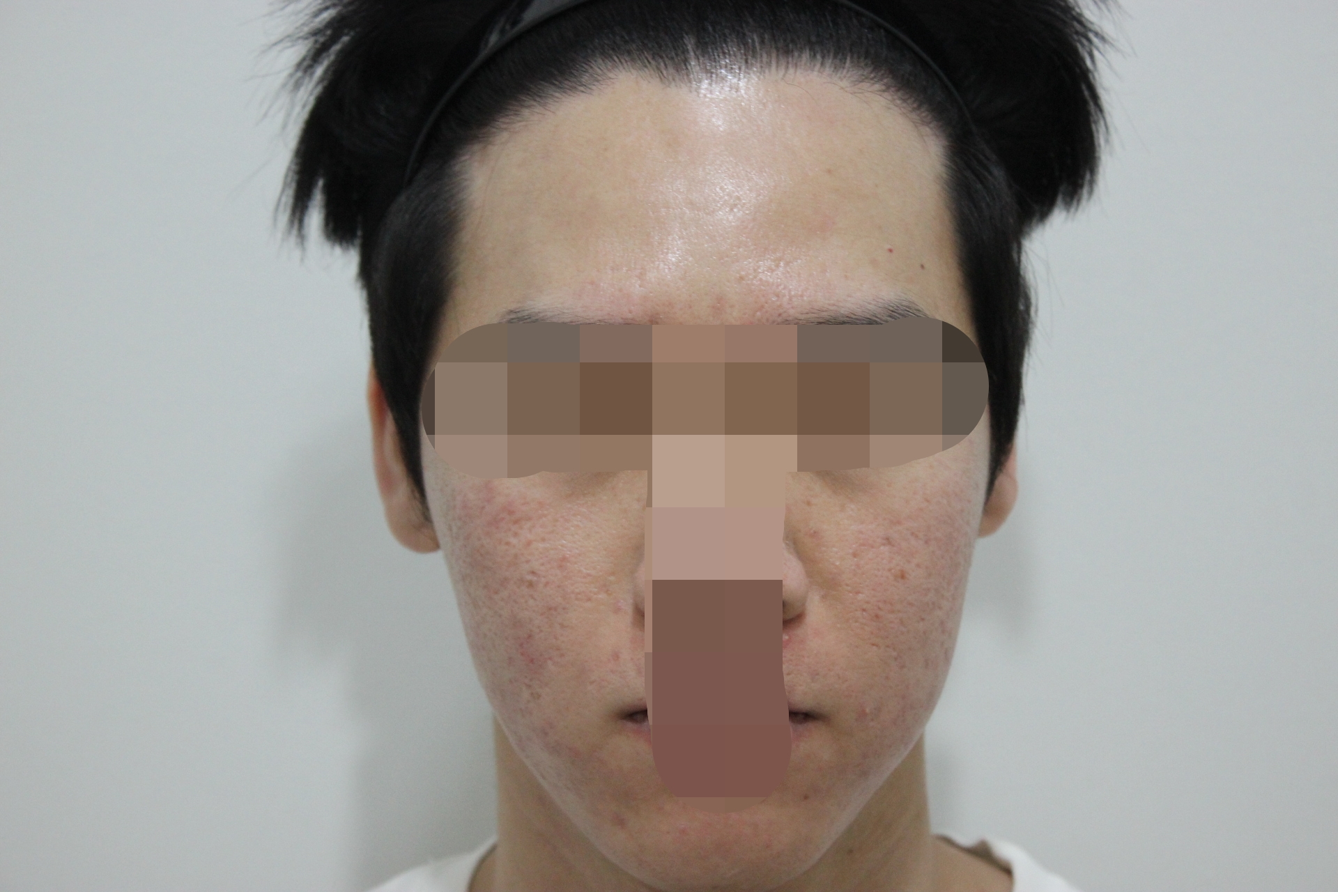 After